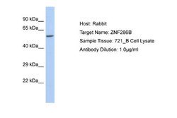 ZNF286B Rabbit anti-Human, Polyclonal, Novus Biologicals 0.1 mL | Buy Online | Novus Biologicals | Fisher Scientific